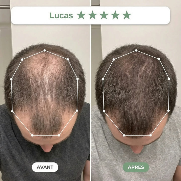 Avant / Après — rituel Clarive (photo non contractuelle, résultats individuels)
