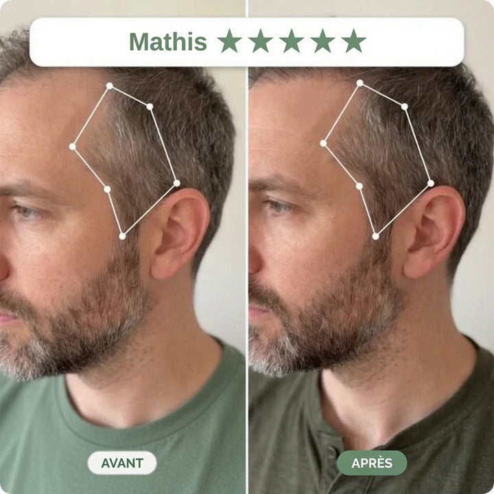 Avant / Après — rituel Clarive (photo non contractuelle, résultats individuels)