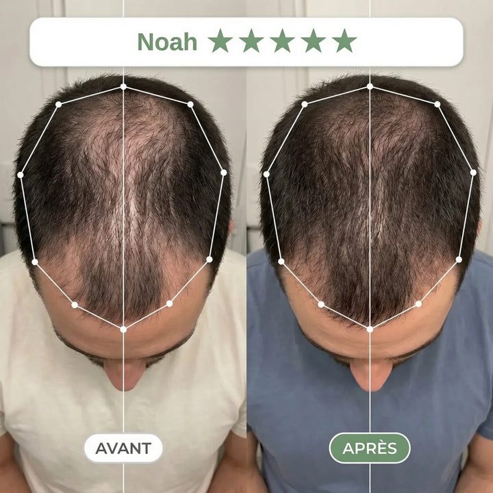 Avant / Après — rituel Clarive (photo non contractuelle, résultats individuels)