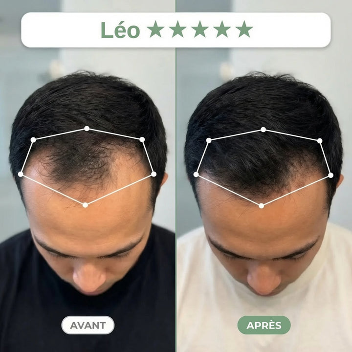 Avant / Après — rituel Clarive (photo non contractuelle, résultats individuels)