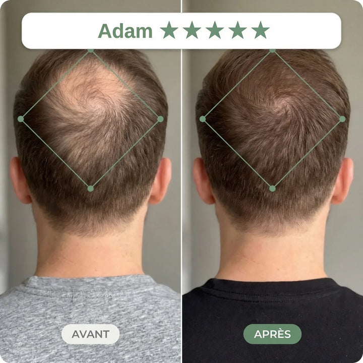 Avant / Après — rituel Clarive (photo non contractuelle, résultats individuels)