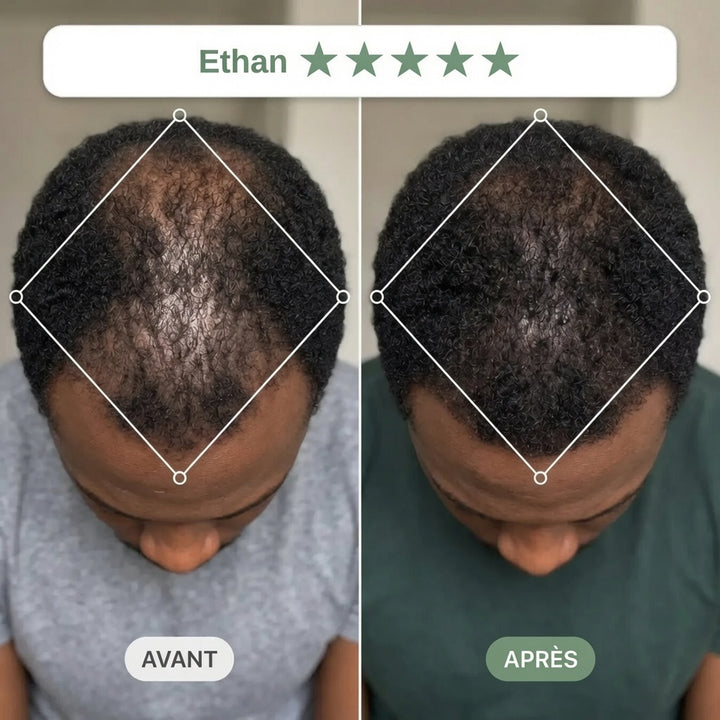 Avant / Après — rituel Clarive (photo non contractuelle, résultats individuels)